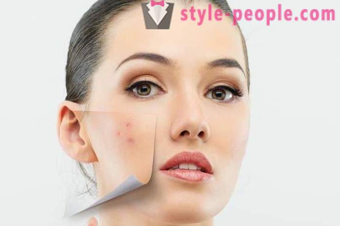 Kāpēc nevar izspiest pimples uz jūsu sejas?