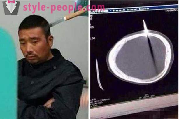 Kāds ķīnietis ar nazi galvā, viņš devās pie ārsta