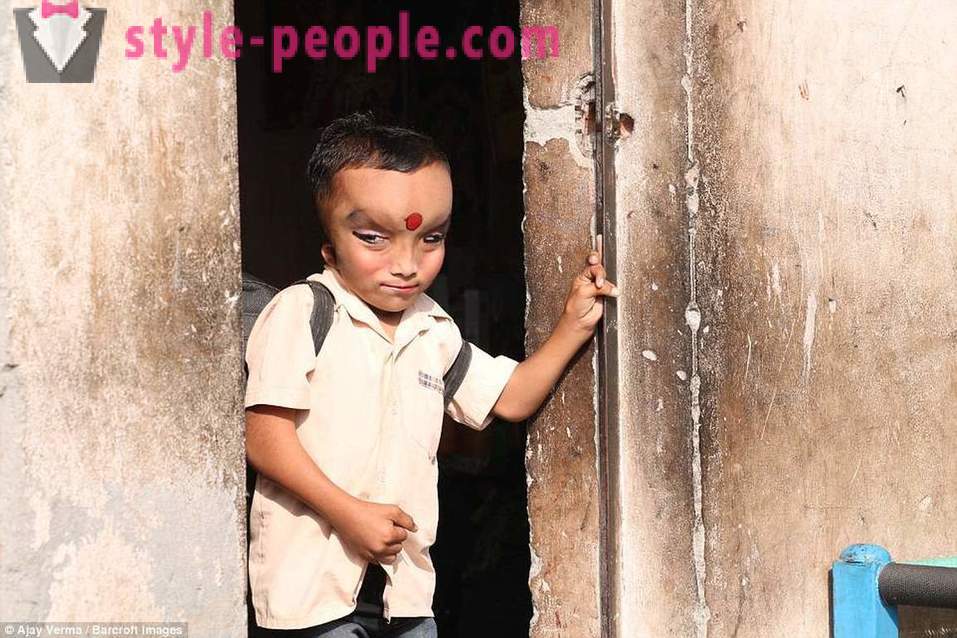 Indijas ciems pielūdz zēns ar deformētu galvu kā dieva apveltīs