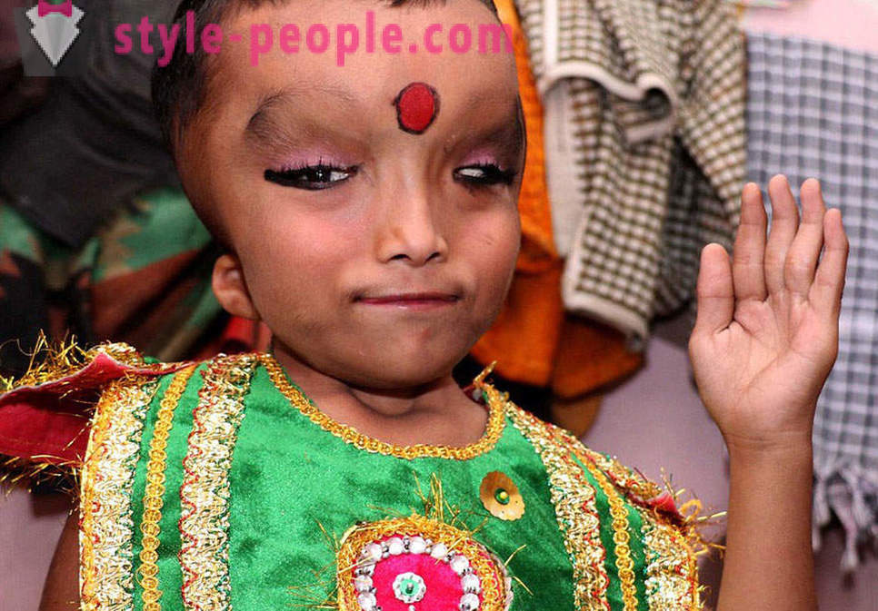 Indijas ciems pielūdz zēns ar deformētu galvu kā dieva apveltīs