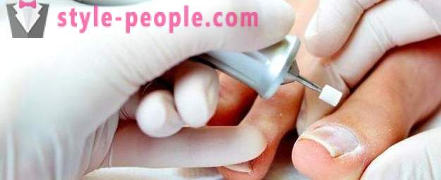 Ieaugušu nagu uz lielā pirksta: cēloņi un ārstēšana